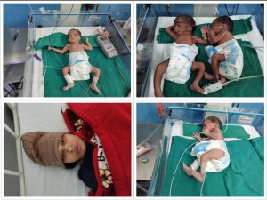 Syangja woman gives birth to quadruplets
