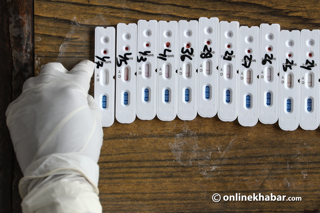 File: Antigen test kits for coronavirus