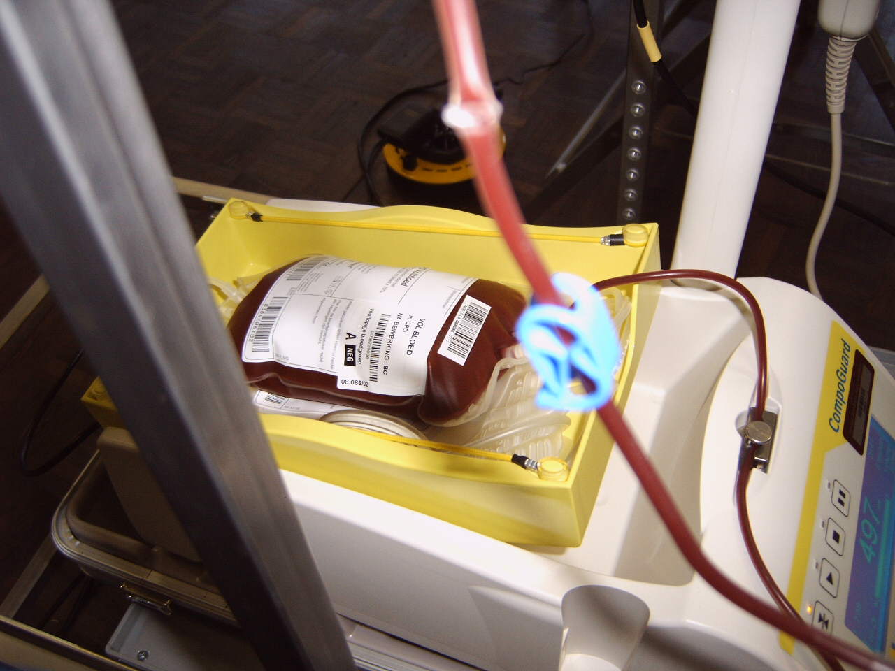 A pint of blood after blood donation. Photo: Wikimedia Commons