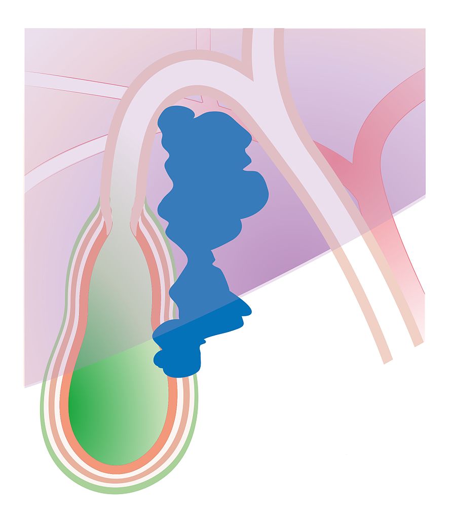 Gallbladder_Cancers in nepal