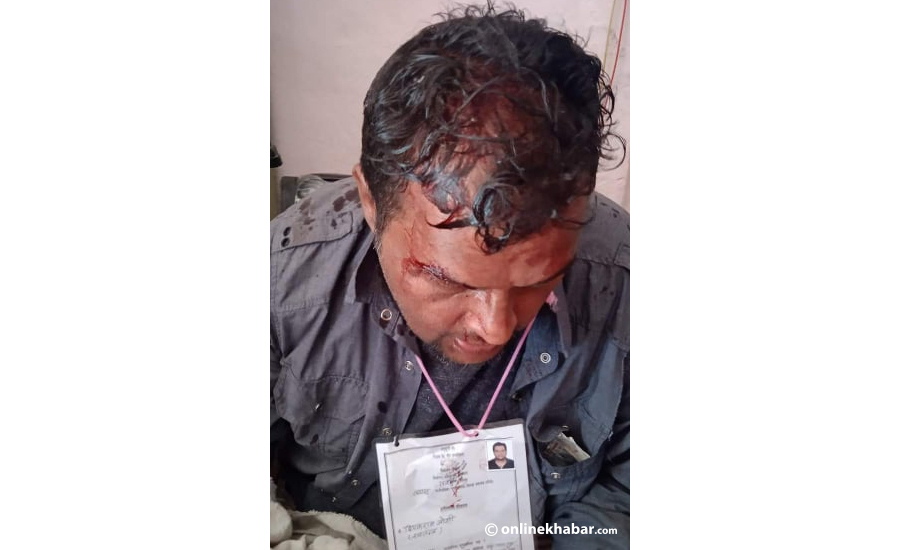 Tanahun's Byas municipality mayoral candidate Deepak Raj Joshi has been injured in an attack, reportedly from Nepali Congress cadres, during the local elections on Friday, May 13, 2022.