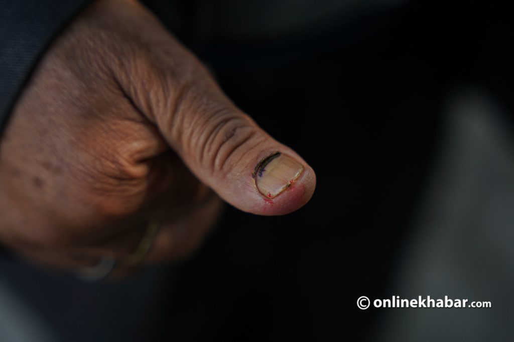 Nepal Elections voting vote revote