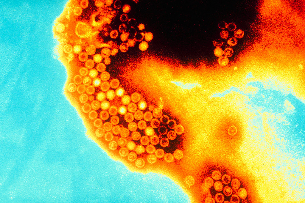 Hepatitis A virus. hepatitis in nepal. Photo: Flickr