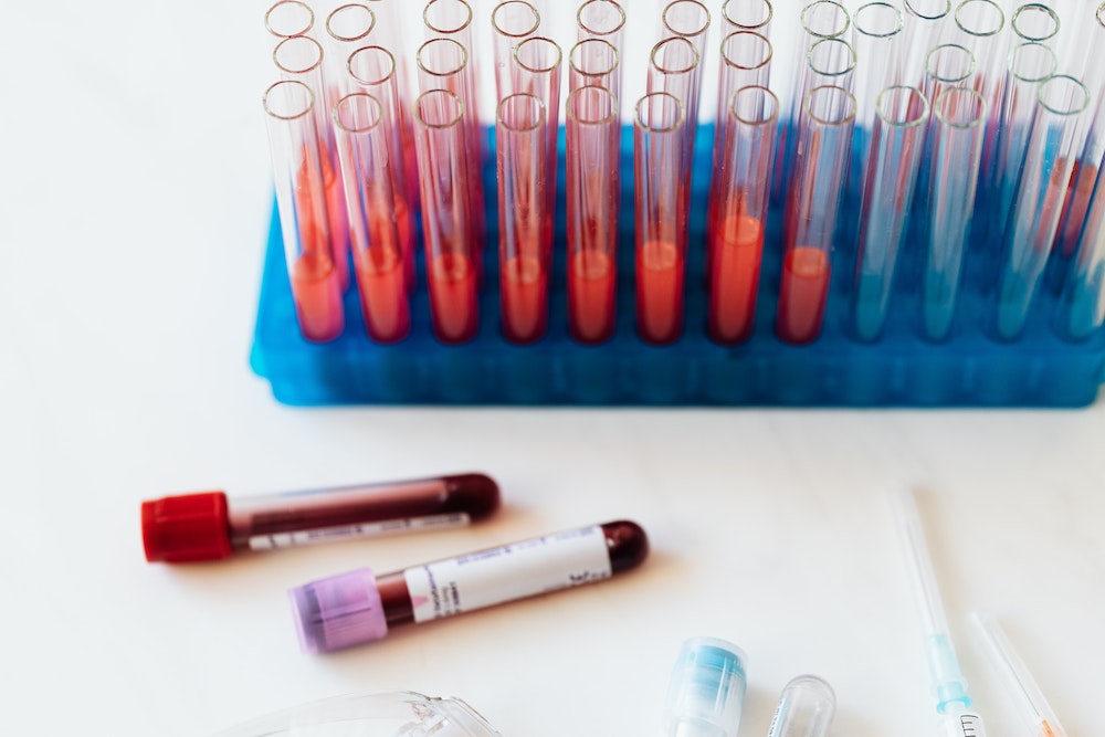 blood test pexels-karolina-grabowska