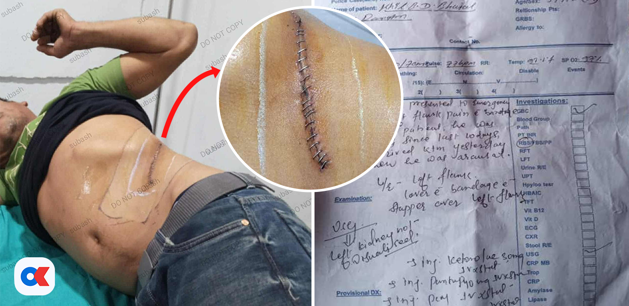 Mastermind of kidney trafficking arrested: Over 100 Nepalis’ kidneys sold in India