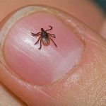 893 scrub typhus cases recorded in Chitwan last fiscal year