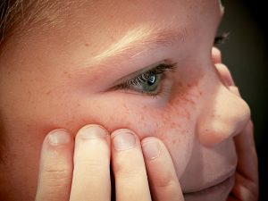 Bangladesh has lost 900 children to measles – a warning to other countries where vaccine rates have slipped