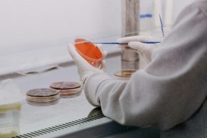 Why a Russian lab worker’s death has raised plague concerns